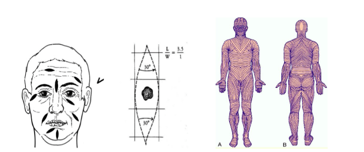 Fermeture cutanée directe Dr Petit