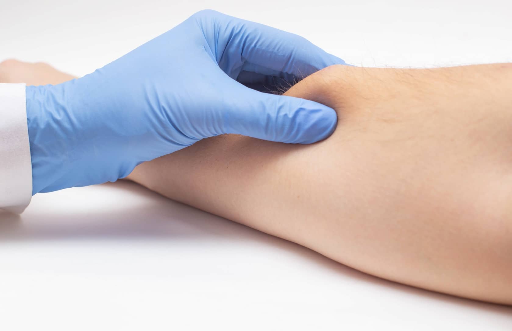 Le lipome est-il un cancer ? | Dr Petit | Paris